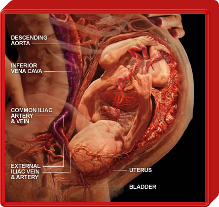Fetus in Uterus Compressing Blood Vessels and Causing High Blood Pressure